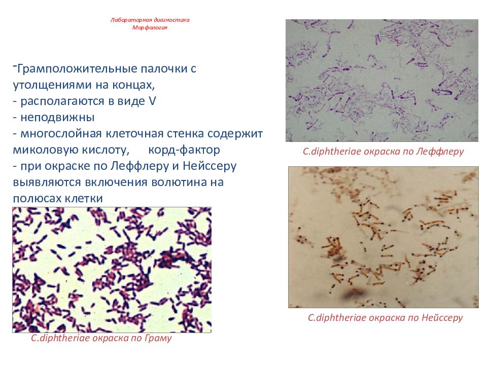 Возбудитель коклюша. Дифтерийная палочка морфология. Бордетеллы морфология. Дифтерия окраска по Граму. Bordetella pertussis окраска по Граму.