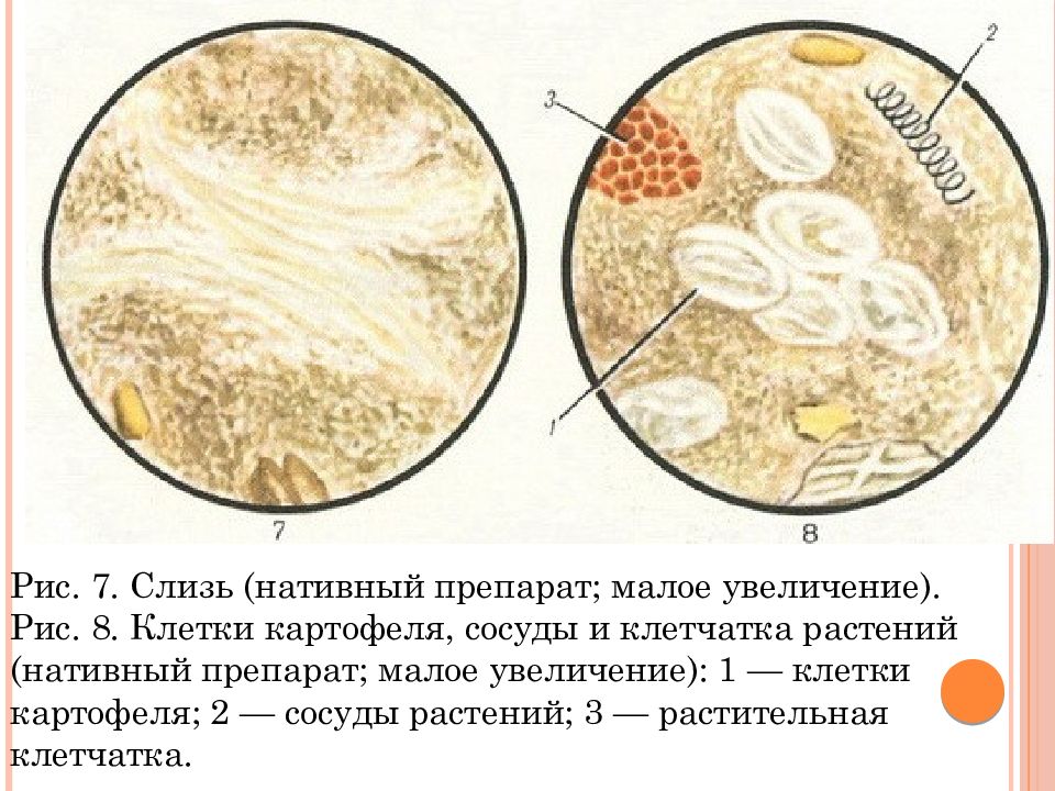 Жир в желчи рисунок