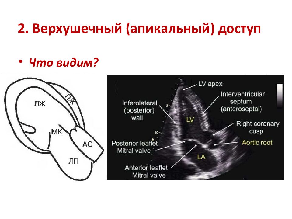 Узи сердца схема