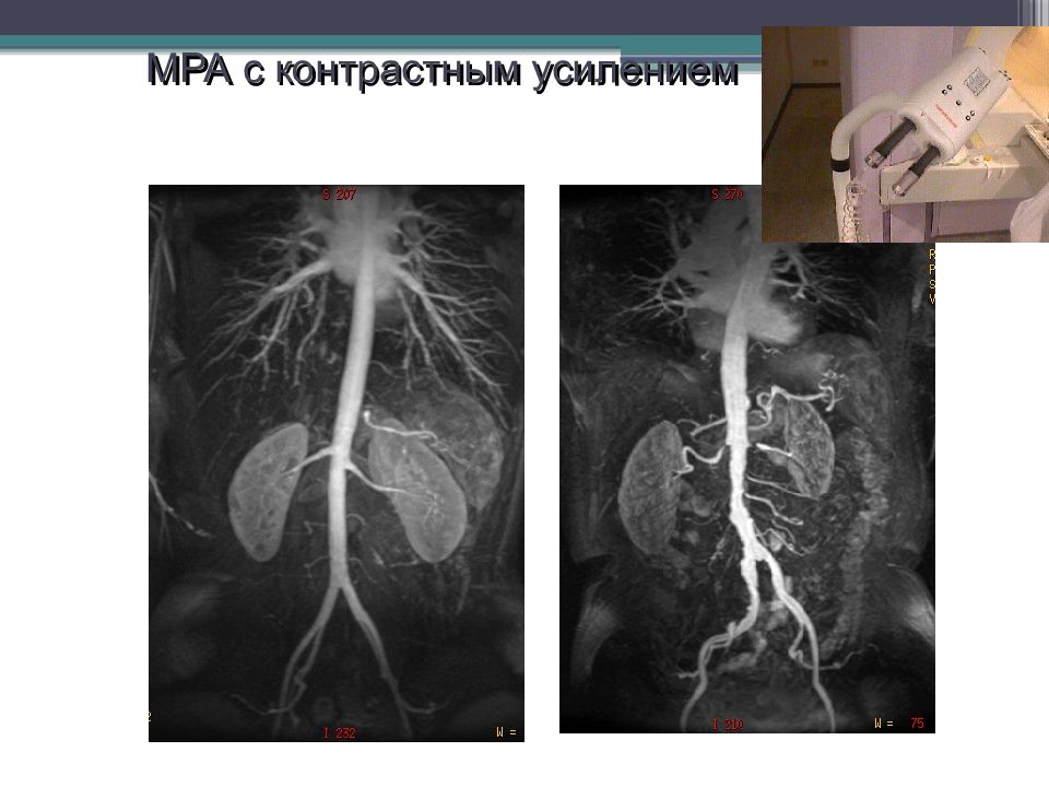 Контраст для мрт. Магнитно резонансные контрастные средства. Контрасты для мрт препараты. Контрастные препараты для ангиографии. Мрт с контрастом.