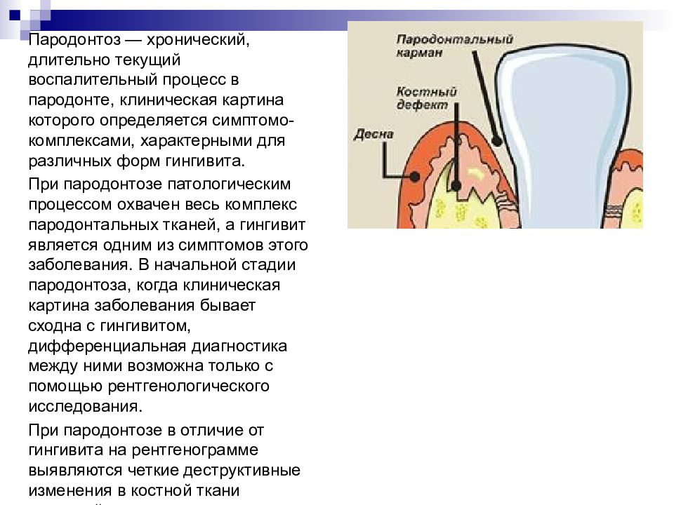 Пародонт тест. Воспалительные процессы в пародонте. Пародонтоз клиническая картина. Для пародонтоза характерно. Заболевания пародонта таблица.