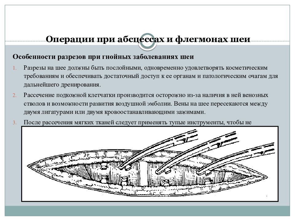 Презентация операции на шее