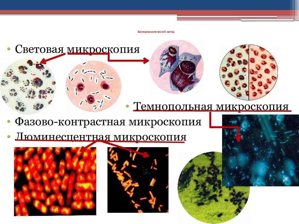 Методы инфекционной диагностики. Бактериоскопический (микроскопический) метод. Бактериоскопический метод микробиология. Методы микробиологической диагностики бактериальных инфекций. Бактериоскопический метод диагностики это в микробиологии.