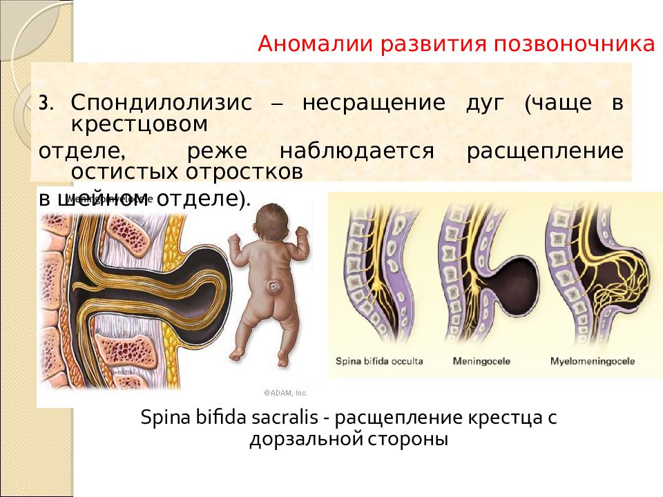 Аномалии развития верхних конечностей презентация