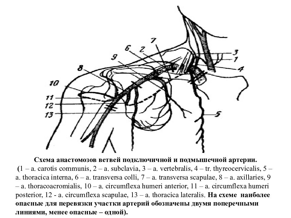 Проекционная линия бедренной артерии. Плечевая артерия схема. Критические уровни перевязки артерий верхних конечностей. Ветви плечевой артерии схема. Артерии верхней конечности схема.