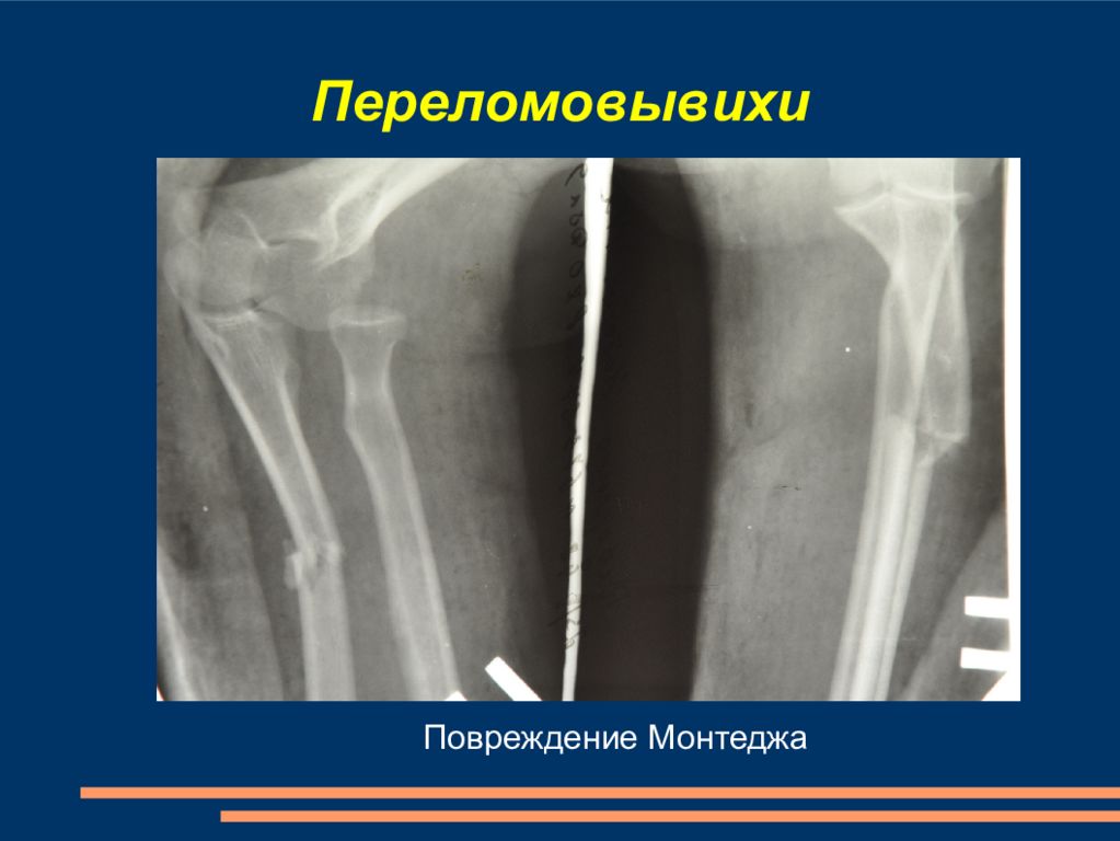 Амбулаторная травматология детского возраста презентация