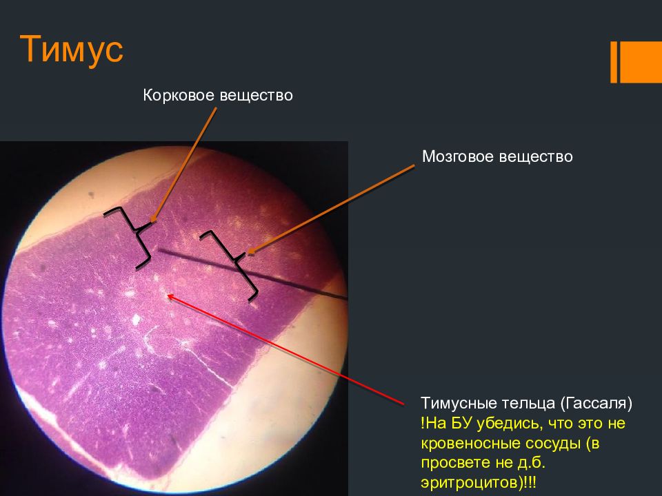 Тимус гистология препарат рисунок