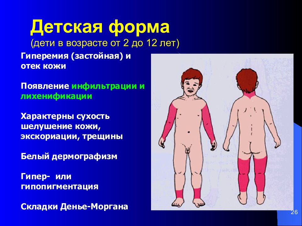 Атопический дерматит у детей презентация