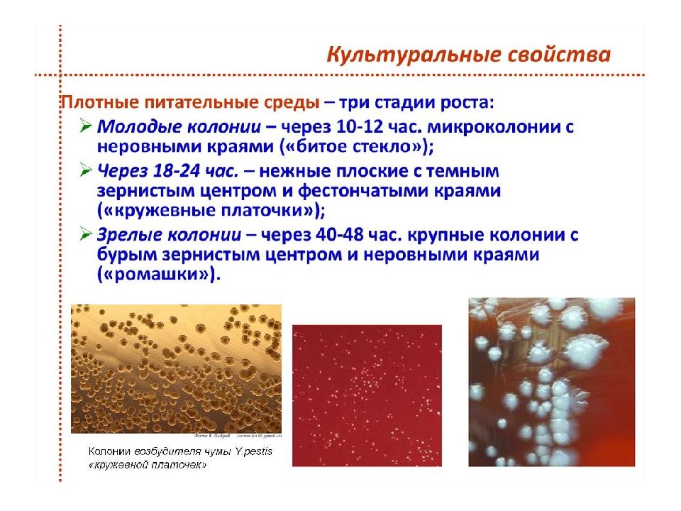 Бруцеллез презентация по микробиологии