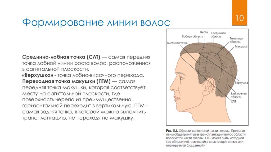 Линия роста волос. Лобная линия волос. Лобная линия роста волос. Лобно-височная линия роста волос. Лобная линия роста волос криминалистика.