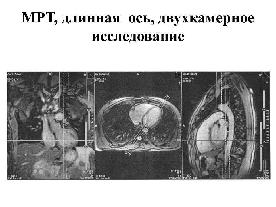 Мрт Сердца Цена В Москве Недорого К31