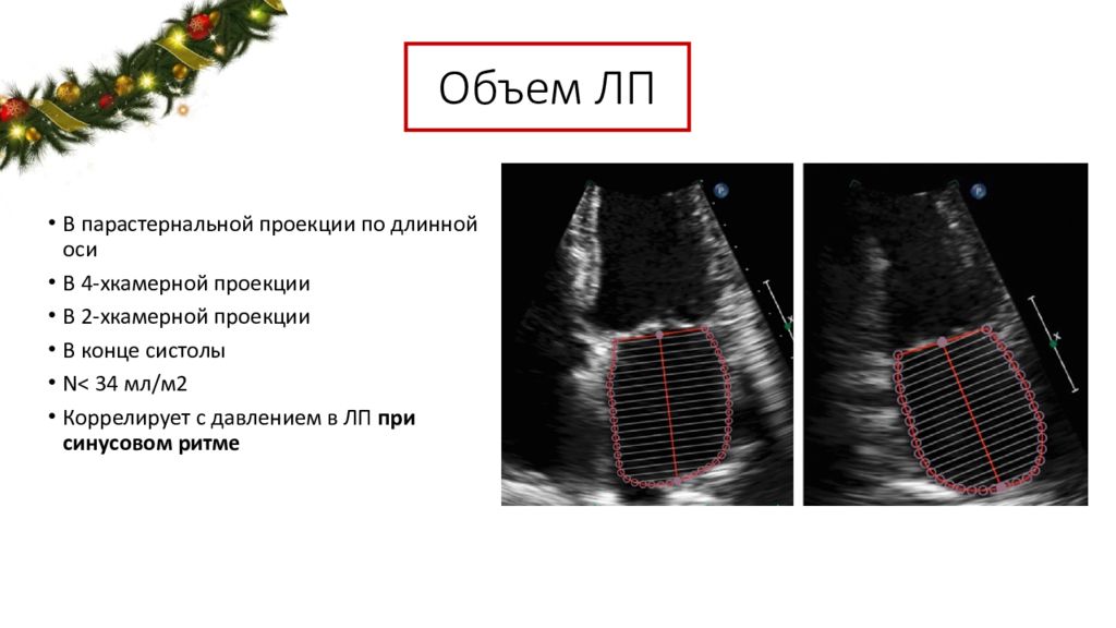 Функции левого желудочка