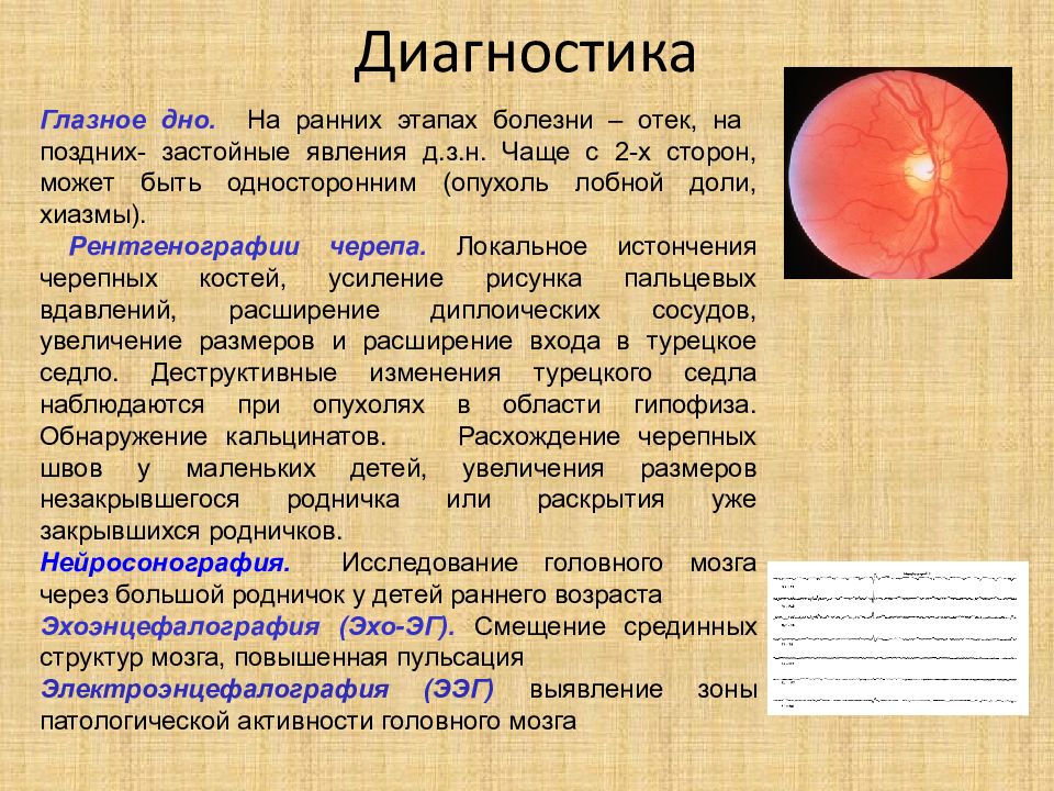 Диагноз день. Отек мозга - глазное дно. Глазное дно при опухолях головного мозга. Изменения глазного дна при опухоли головного мозга. Глазное дно застойные явления.