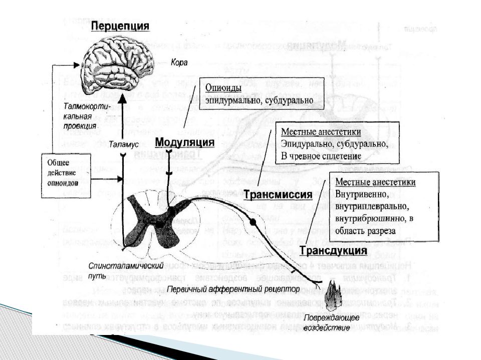 Мультимодальная анестезия презентация