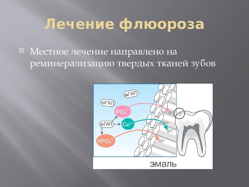 Диагностика флюороза