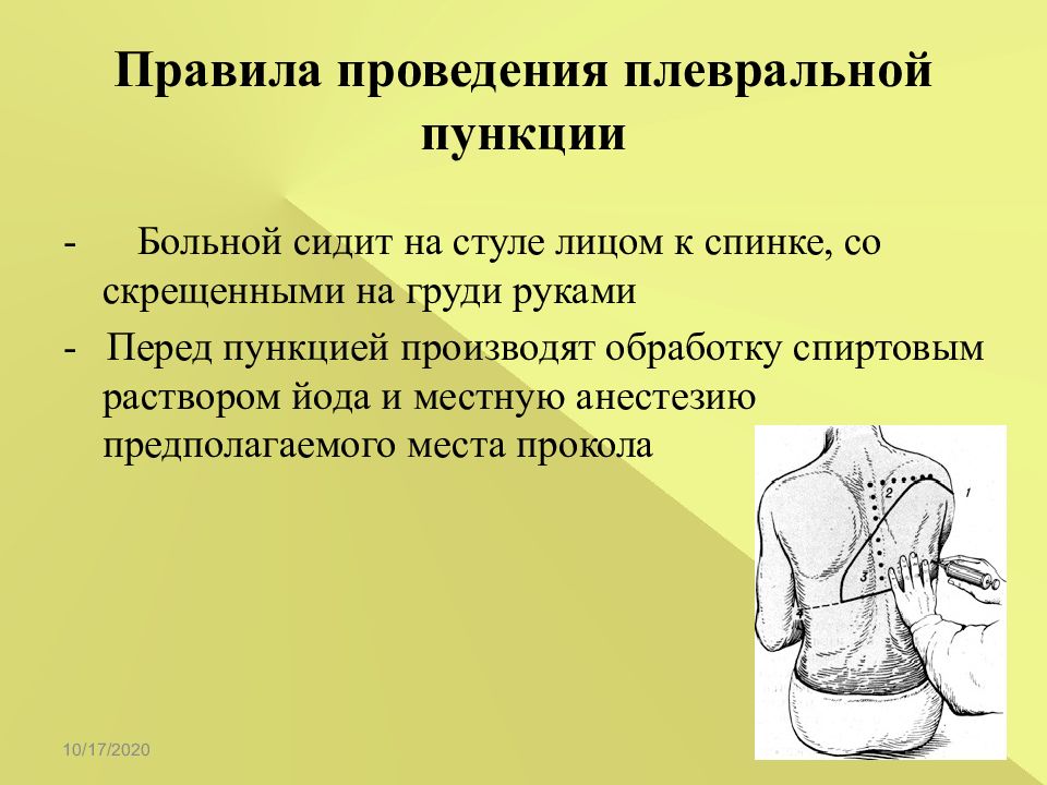 Полость проводиться. Проведение плевральной пункции. Методика выполнения плевральной пункции. Подготовка пациента к проведению плевральной пункции. Плевральная пункция техника проведения.