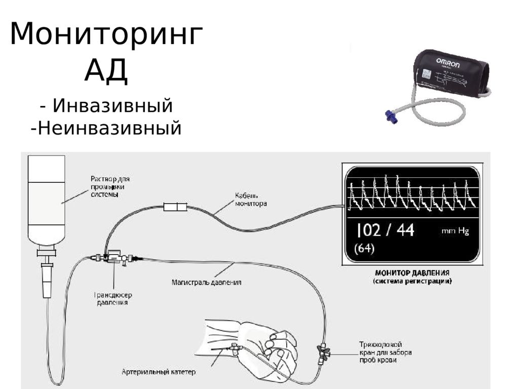 Инвазивный и неинвазивный. Инвазивный метод измерения давления. Инвазивный (прямой) метод измерения артериального давления.. Инвазивный датчик артериального давления. Датчик для измерения инвазивного ад.