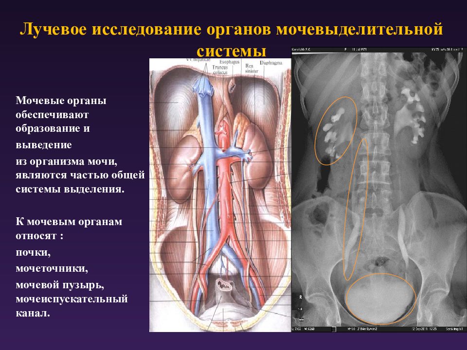 Лучевая анатомия семиотика