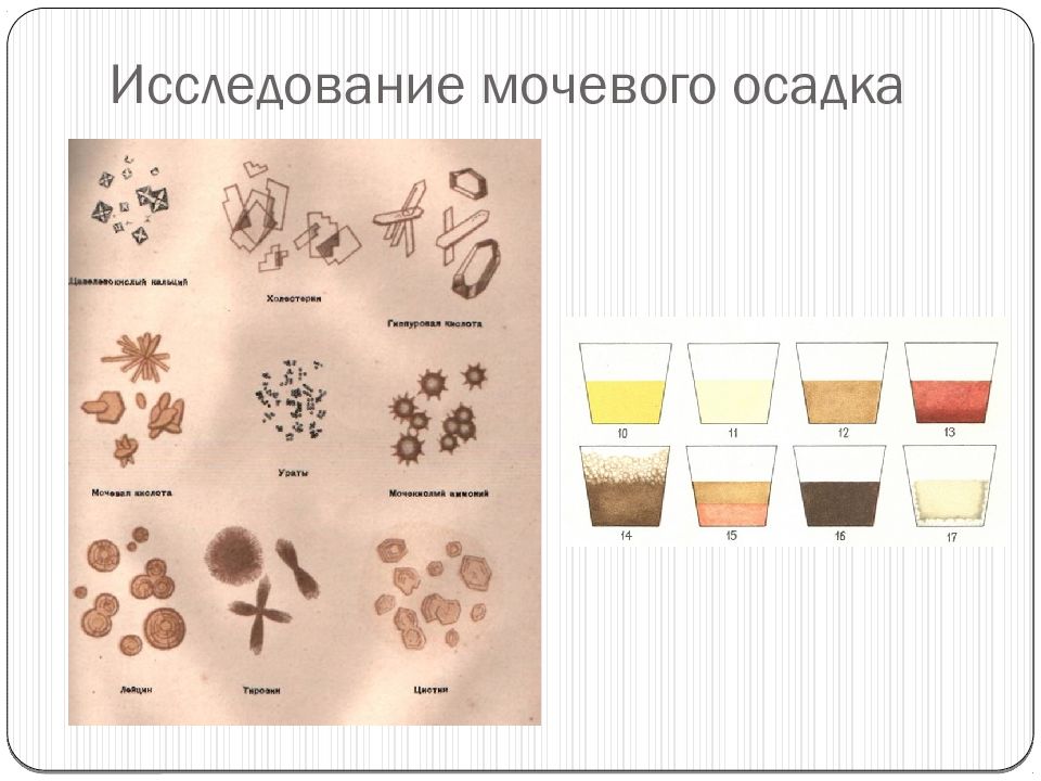 Микроскопия осадка мочи фото с описанием