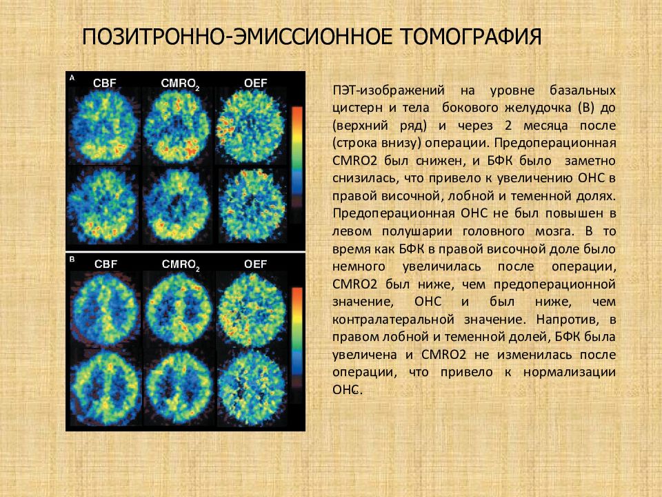 Опухоли головного и спинного мозга презентация